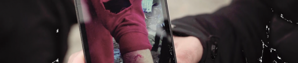 Image 1 – H., migrant, nous montre sur son téléphone les blessures occasionnées par un berger allemand que les forces de l’ordre lui ont lâché dessus à Calais